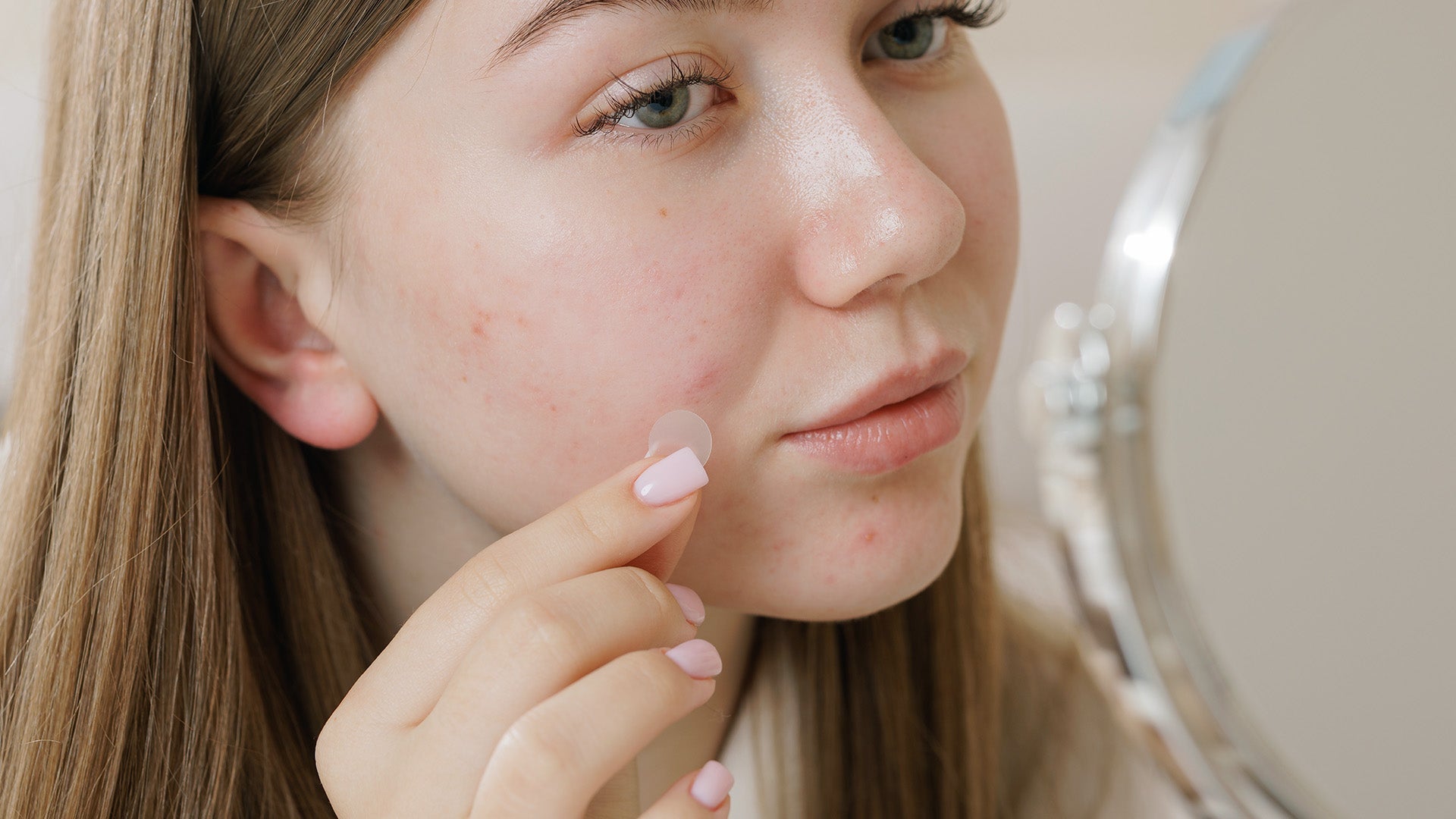 Acne Skincare Tips