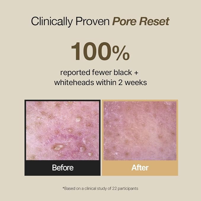 Phyto Mucin Rice Scrub Foam Cleanser